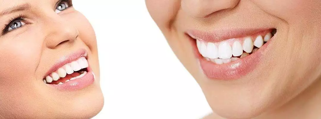 The Ultimate Guide to Achieving a Radiant Smile