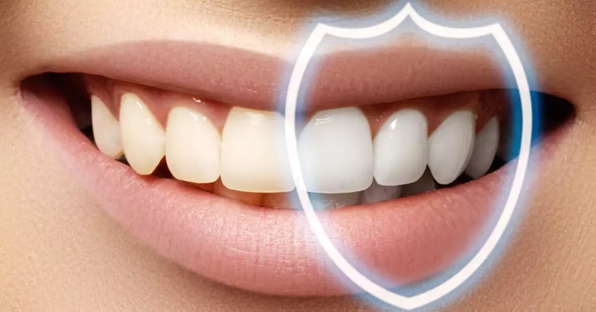 Dental Bonding In Gurugram Dental Bonding In Gurugram