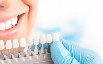 The Secret to Whiter Teeth: Professional vs. At-Home Whitening