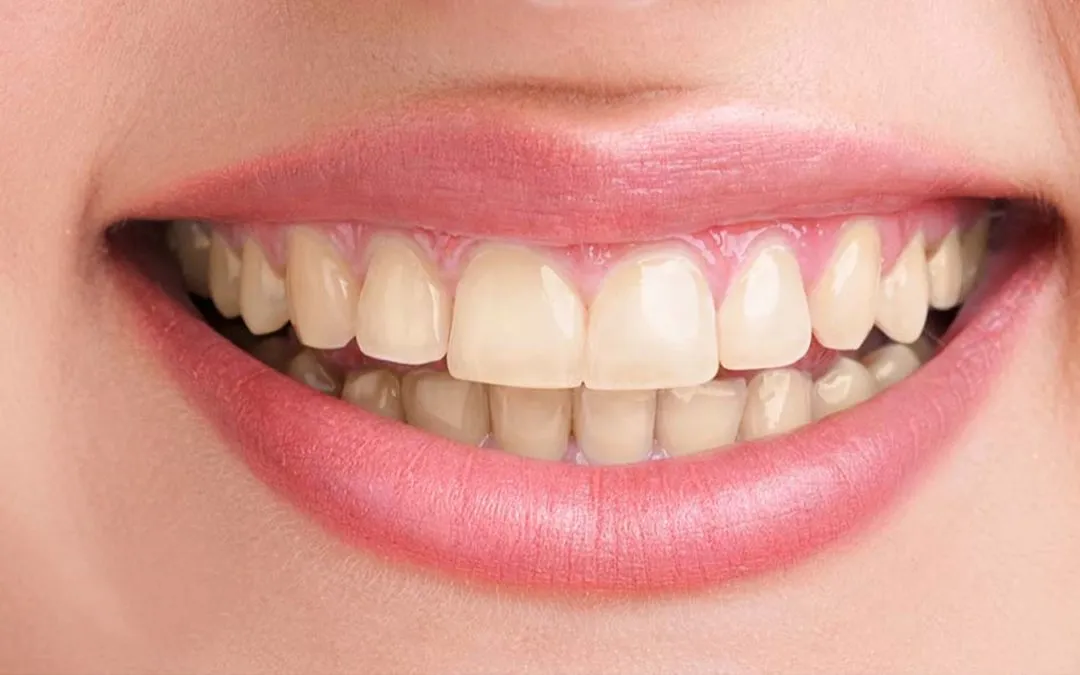 Cosmetic Dentistry in Gurgaon: Transform Your Smile with Modern Treatments